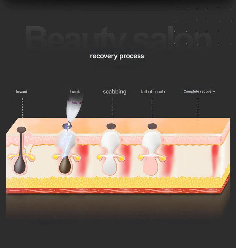 Professional 9-Level Skin Tag & Spot Remover Pen - USB Rechargeable Beauty Device(Blue)