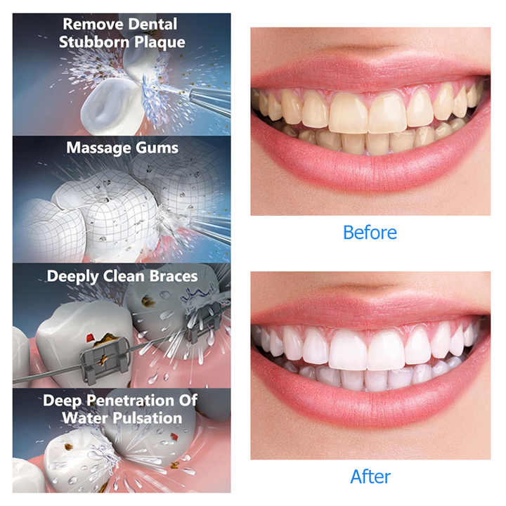 White Advanced Portable Water Flosser - Rechargeable Oral Irrigator, IPX7 Waterproof, 4 Cleaning Modes for Deep Dental Care