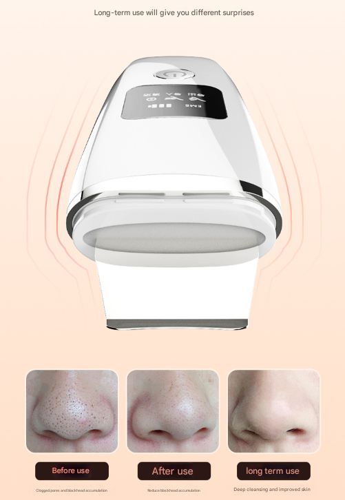 White Professional 4-in-1 Ultrasonic Skin Scrubber - Deep Pore Cleanser, Blackhead Remover & EMS Facial Lifting Tool
