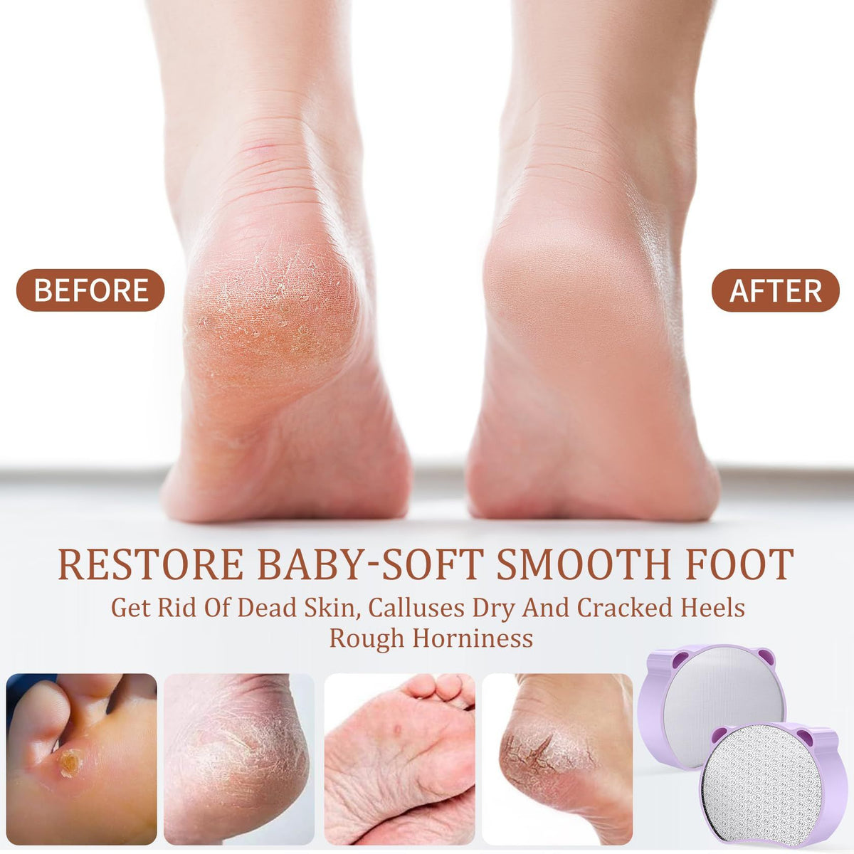 Hair Removal, Nail and Foot Beauty Tools, Double-Sided and Multifunctional. Compact and Portable,  1Pcs Purple