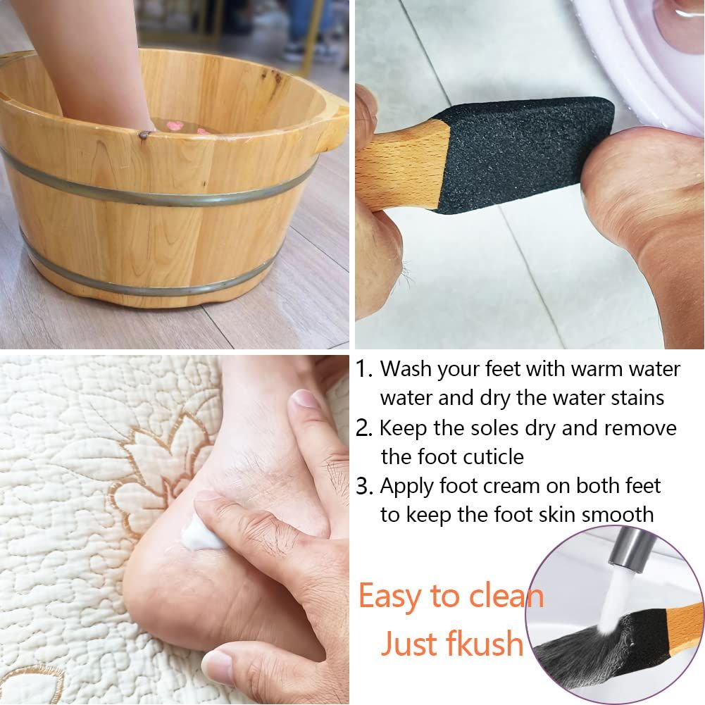 Exfoliator Pedicure Tool Foot Callus Remover Scrubber for Dead Skin,Corn and Hard Skin - Pumice Stone for Cracked Feet
