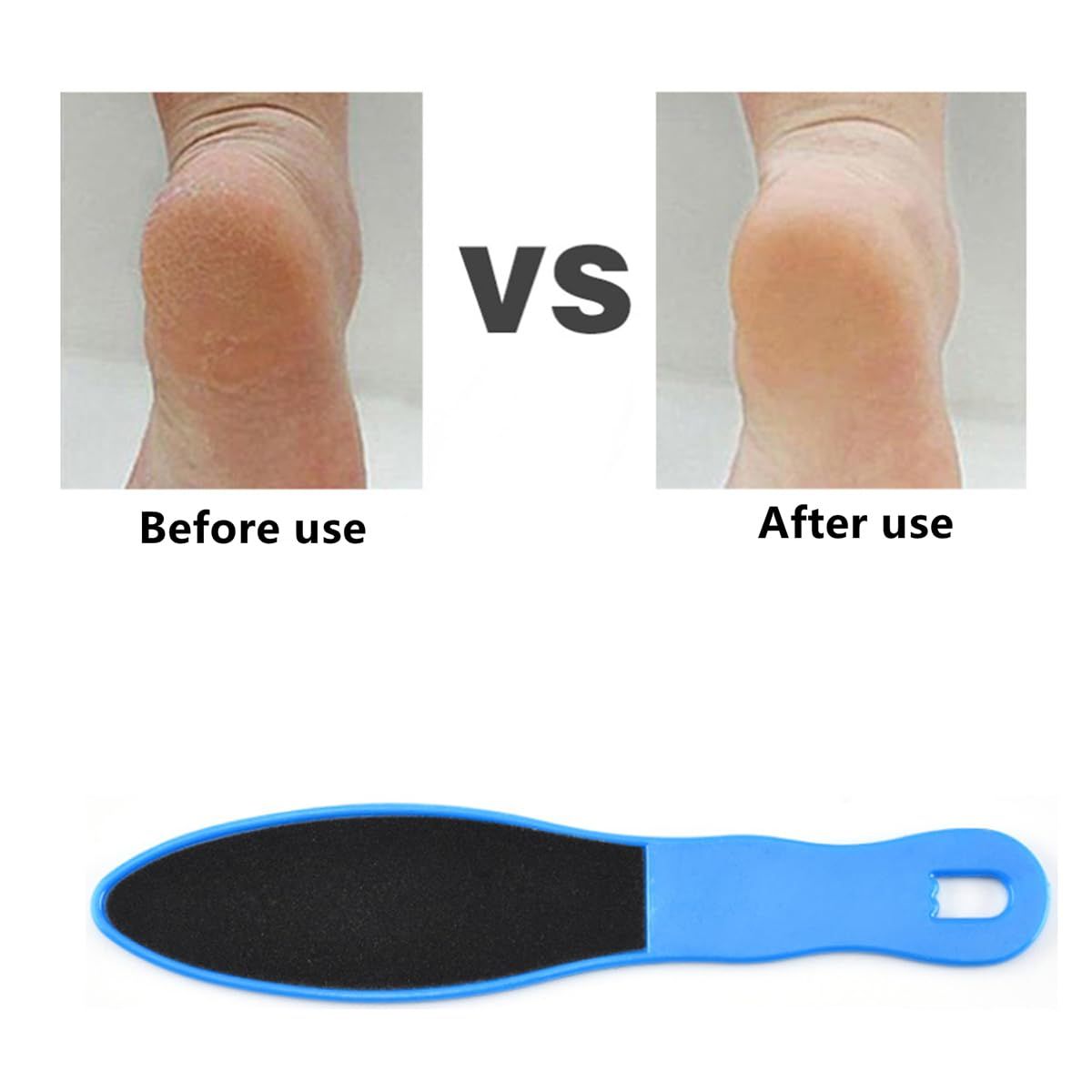 2pcs Double-Sided Foot Scraper, Reusable Foot File for Hard Skin Removal, Foot Scrubber for Wet Dry Cracked Heels