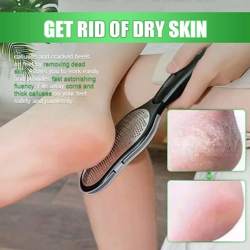 Pedicure Knife Foot Sharpeners,Stainless Steel Foot File Exfoliating Pedicure Device Foot Care Remove Hard Skin Foot File