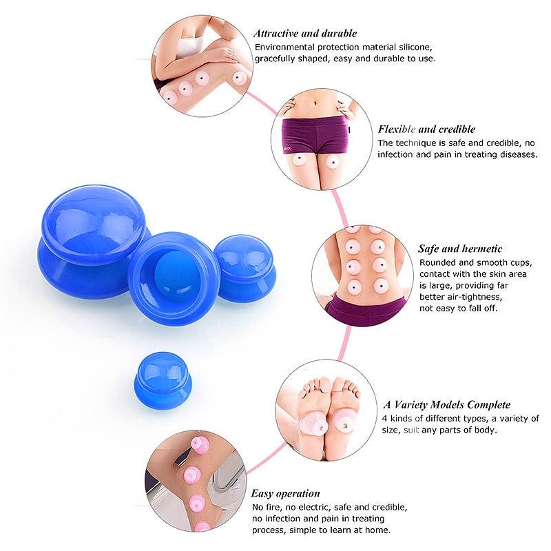 4-Piece Silicone Cupping Therapy Set For Body Massage - White