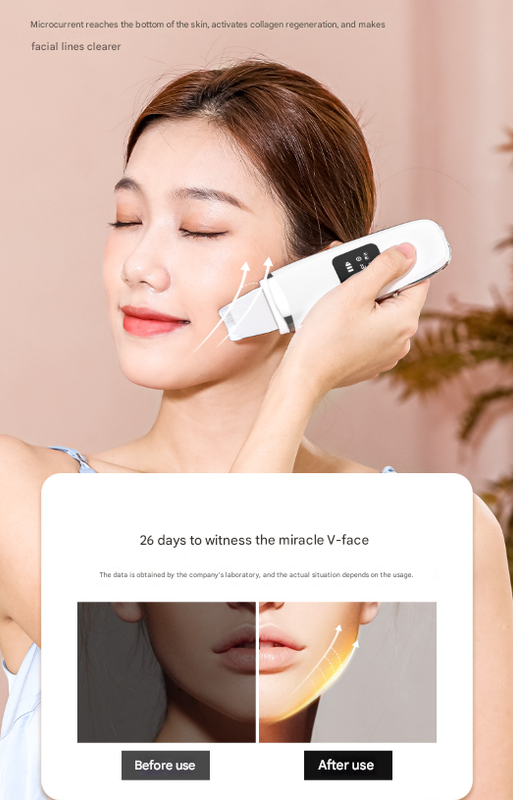 White Professional 4-in-1 Ultrasonic Skin Scrubber - Deep Pore Cleanser, Blackhead Remover & EMS Facial Lifting Tool